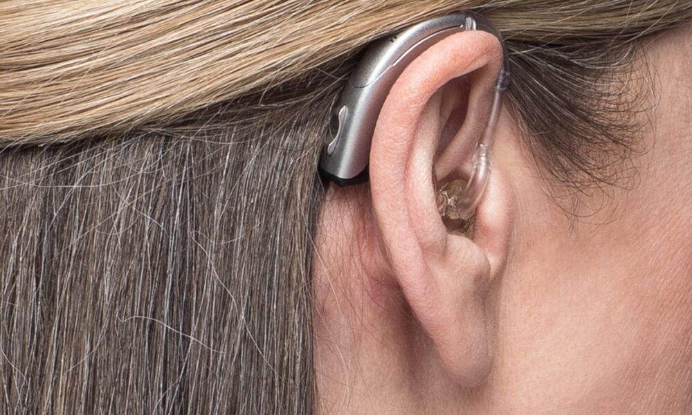 Do I Need a Hearing Aid for Mild Hearing Loss?