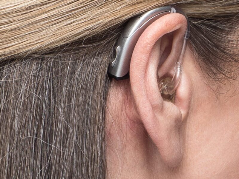 Do I Need a Hearing Aid for Mild Hearing Loss?